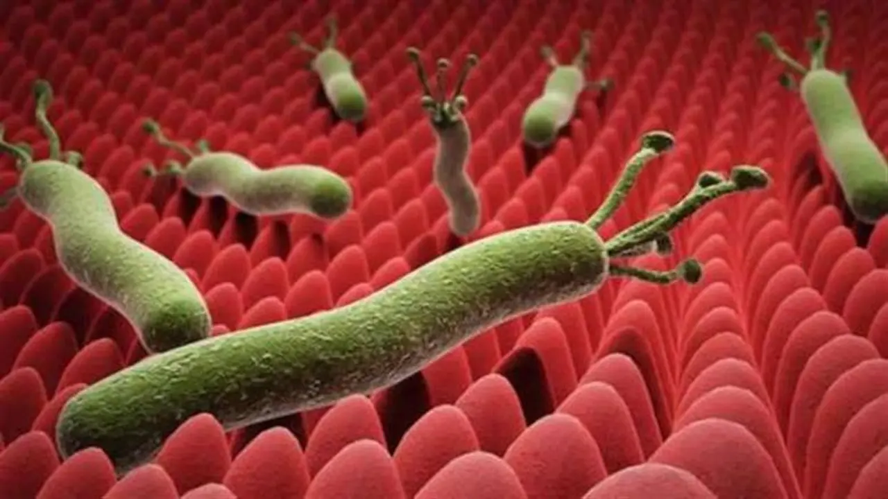 جرثومة المعدة تؤثر على نصف سكان بعض الدول.. 7 أعراض رئيسية وطريقة علاج فعالة